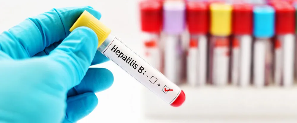 Hepatit B Nedir?